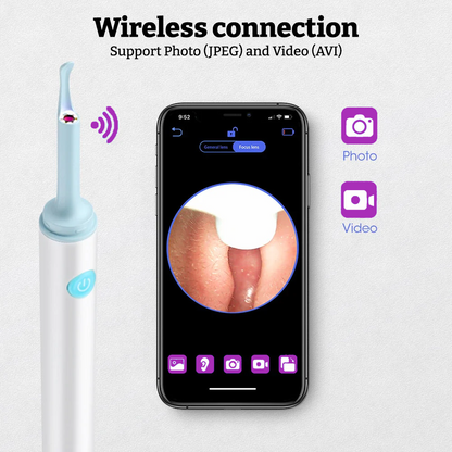 Amsterra™ - Wireless In Ear Endoscope with Mini Camera